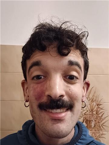 Matteo