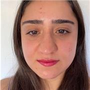 Naz